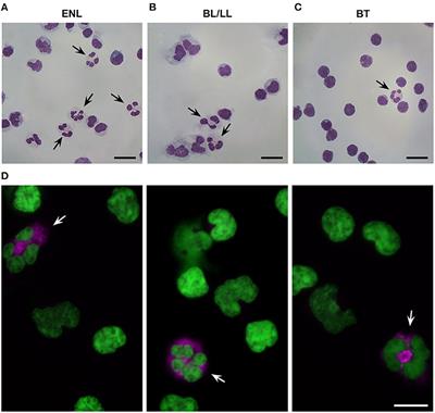 Mycobacterium leprae Induces Neutrophilic Degranulation and Low-Density Neutrophil Generation During Erythema Nodosum Leprosum